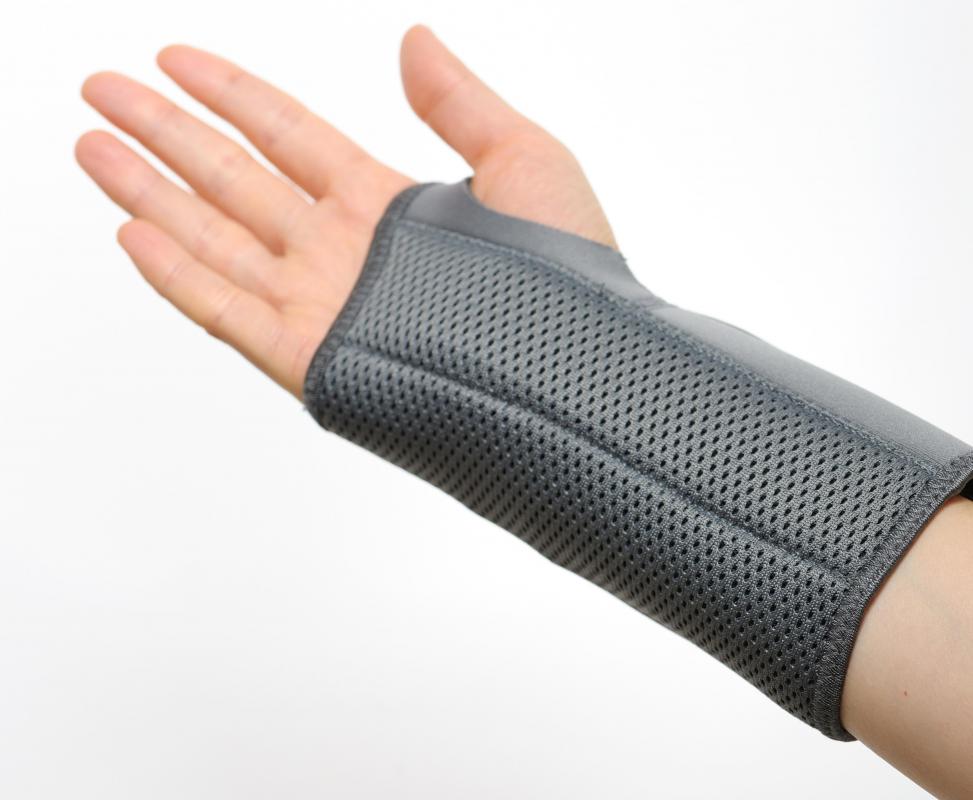 A wrist brace may be worn to alleviate the pain associated with carpal tunnel syndrome.