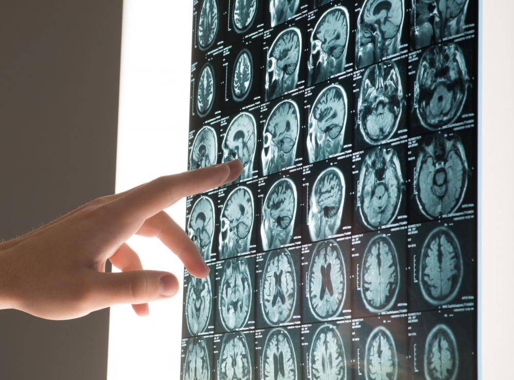 Image reconstruction involves the assembly of two- or three-dimensional images from scattered or incomplete data.