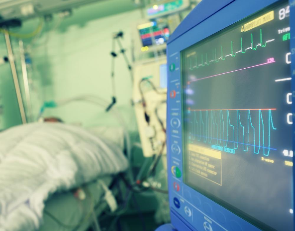 An ECG amplifier allows the weak signals to be displayed on a monitor, ensuring nurses and doctors can address any problems immediately.