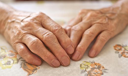 Carpal tunnel is the most common office-related injury.