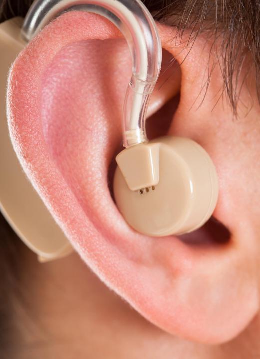 Modern hearing aids are either analog or digital.