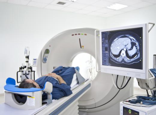 In magnetic resonance imaging, a computer must take the output from the MRI and provide it in a visible form for the user, a form of processing.