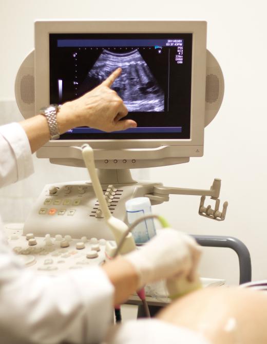 Ultrasound imaging relies on transducers to convert sound energy into electrical pulses.