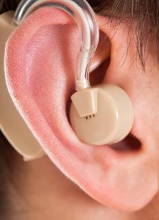 助听器技术有哪些不同类型？